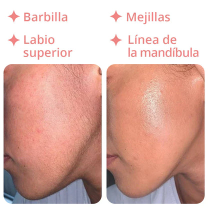 Depiladora 18K - Removedor de Vello Facial Pro